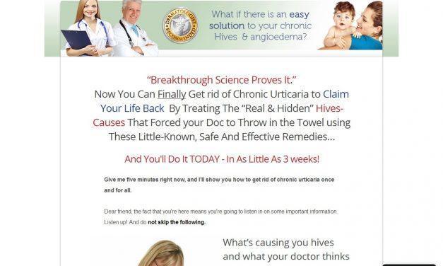 Urticaria No More® Official Website | You Are Not Alone! – Urticaria No More Official